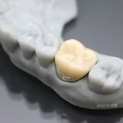 Detax - Freeprint Temp - Classe IIa - A1 - 500 G -3D Prima Boutique DetaxFreeprintTemp 1 7f635005 4e5b 48a1 8123 9455159d2eea